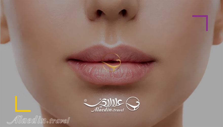 پروتز لب در ایران | علاءالدین تراول